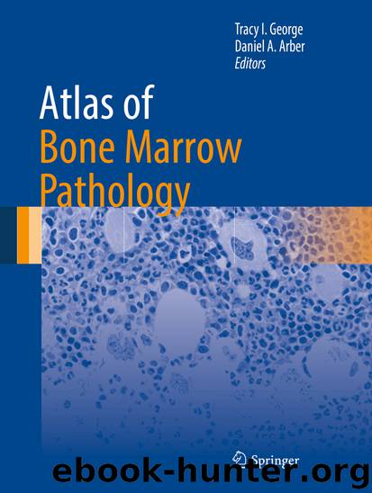 Atlas of Bone Marrow Pathology by Tracy I. George & Daniel A. Arber