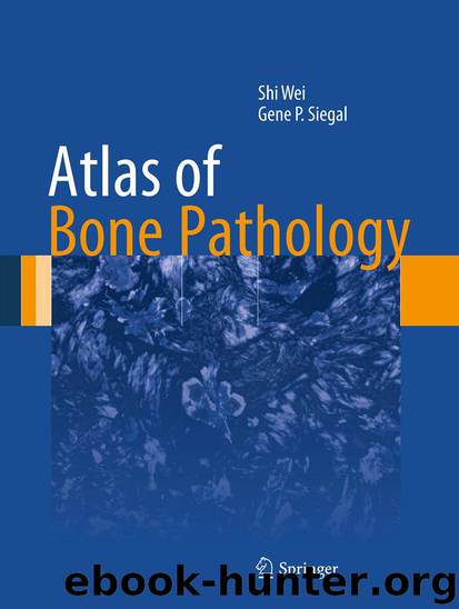 Atlas of Bone Pathology by Shi Wei & Gene P. Siegal