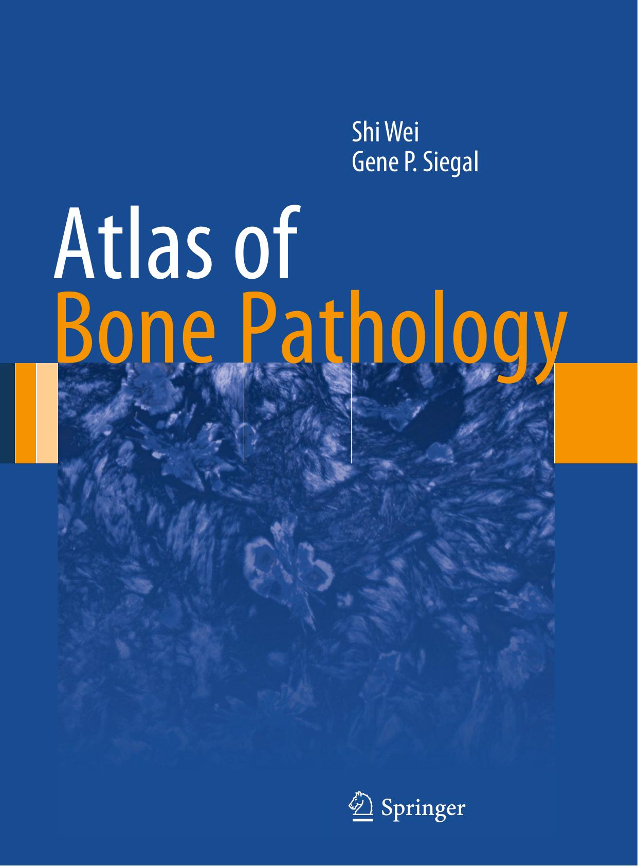 Atlas of Bone Pathology by Shi Wei Gene P. Siegal (auth.)