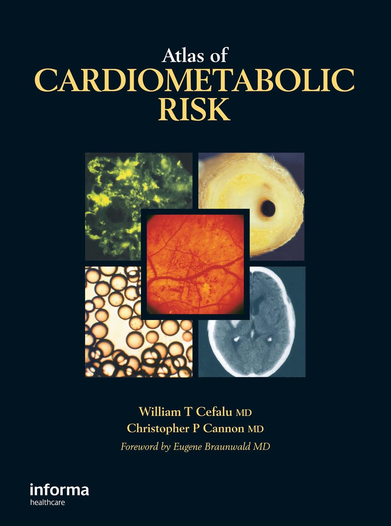 Atlas of Cardiometabolic Risk by William T. Cefalu Christopher P. Cannon