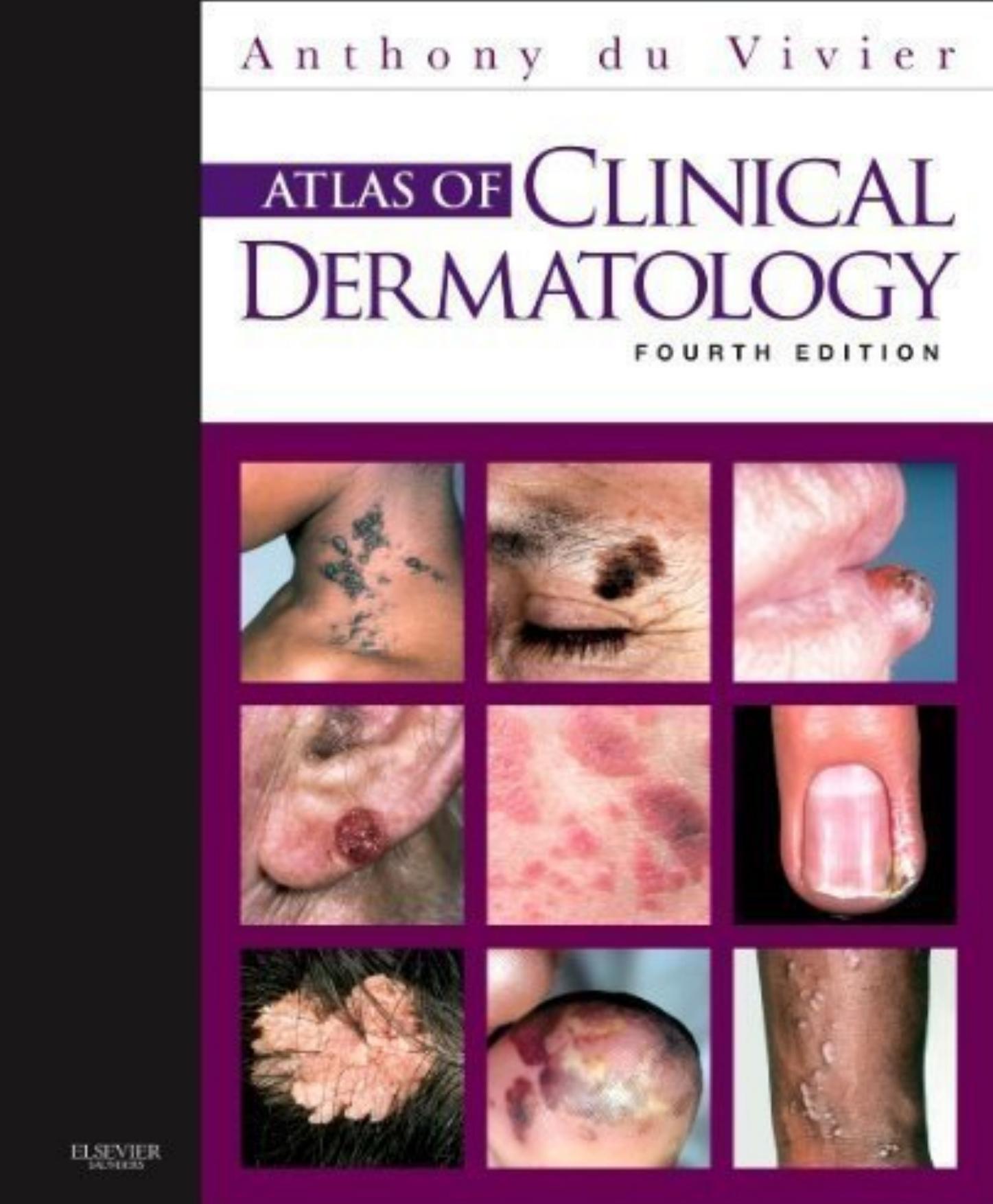 Atlas of Clinical Dermatology by Anthony du Vivier