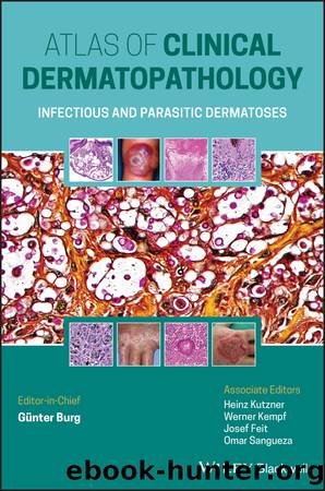 Atlas of Clinical Dermatopathology by Burg Günter; Kutzner Heinz; Kempf Werner