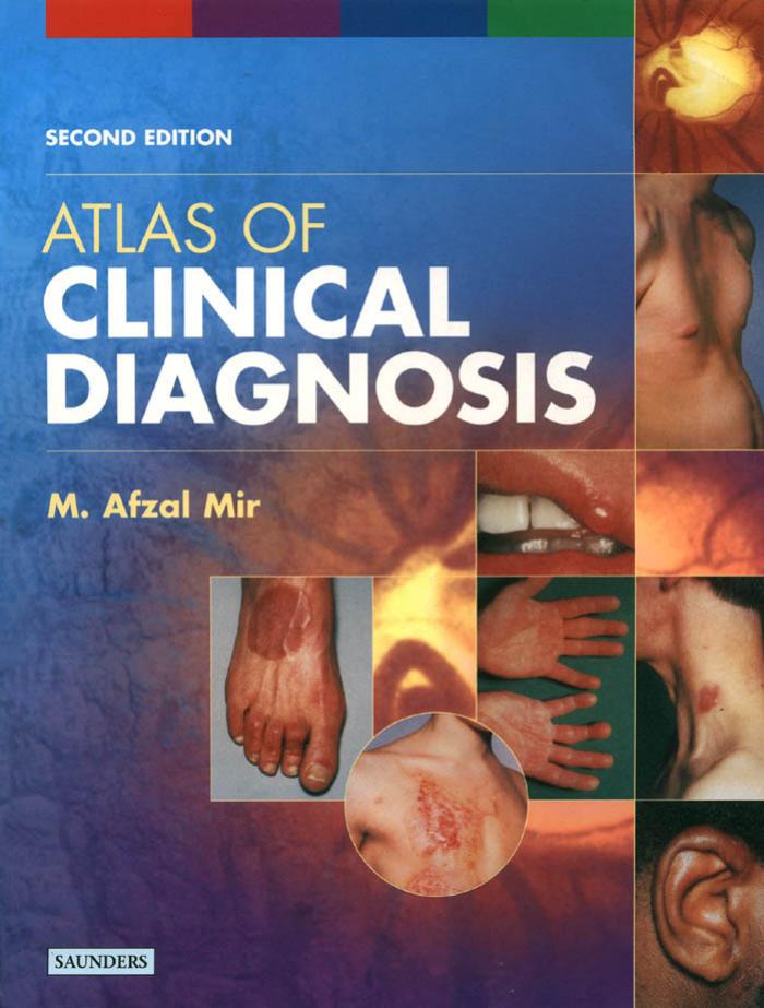 Atlas of Clinical Diagnosis, 2nd Edition by Unknown