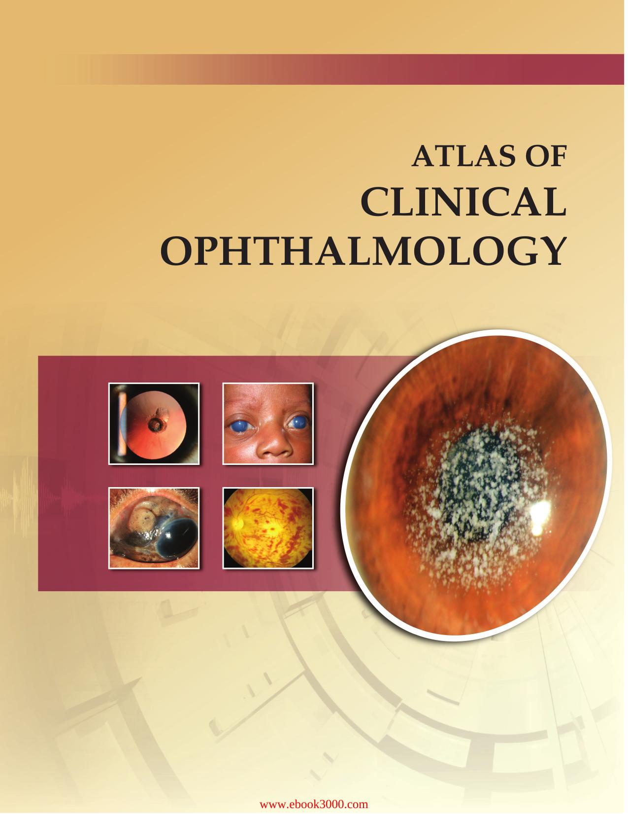Atlas of Clinical Ophthalmology by Unknow