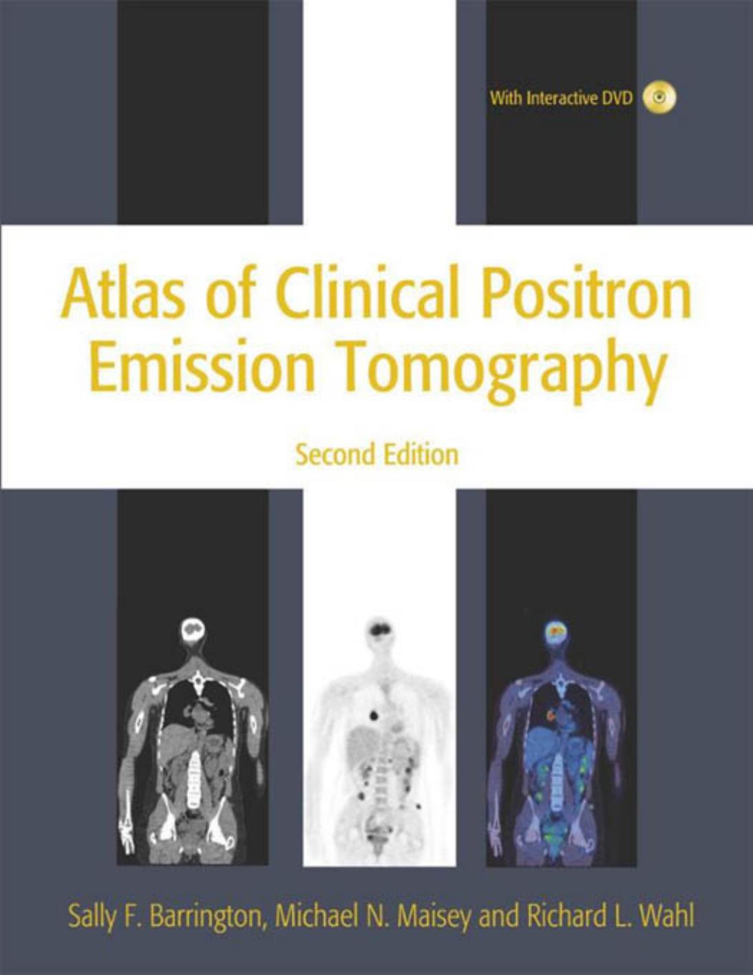 Atlas of Clinical Positron Emission Tomography 2nd Edition by Barrington Sally