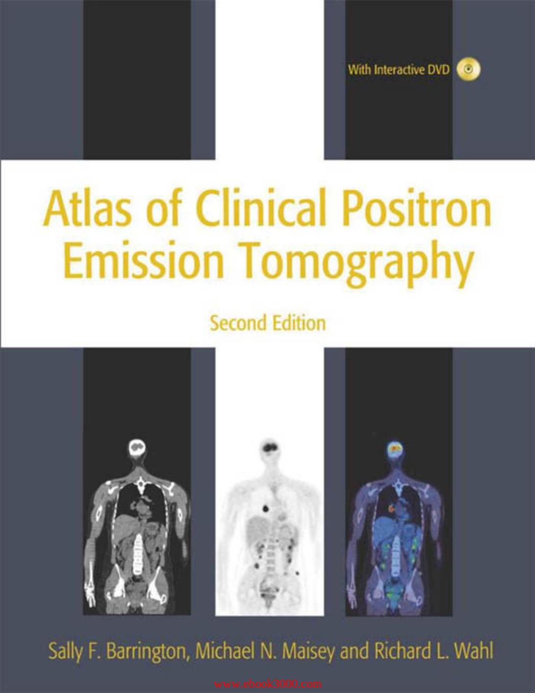 Atlas of Clinical Positron Emission Tomography, 2nd Edition by Unknow