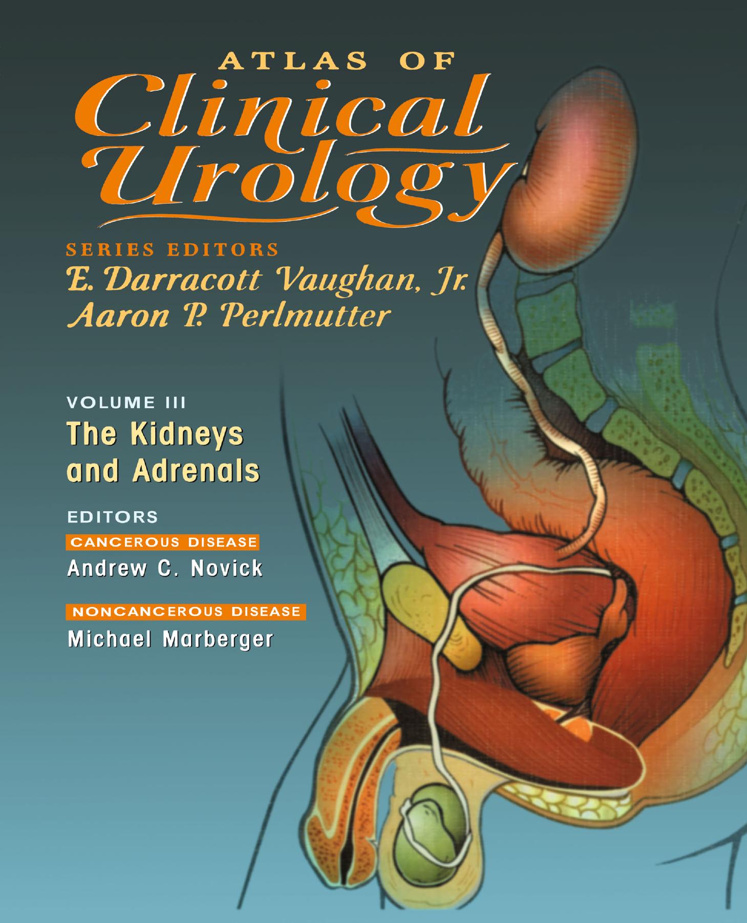 Atlas of Clinical Urology: The Kidneys and Adrenals by unknow