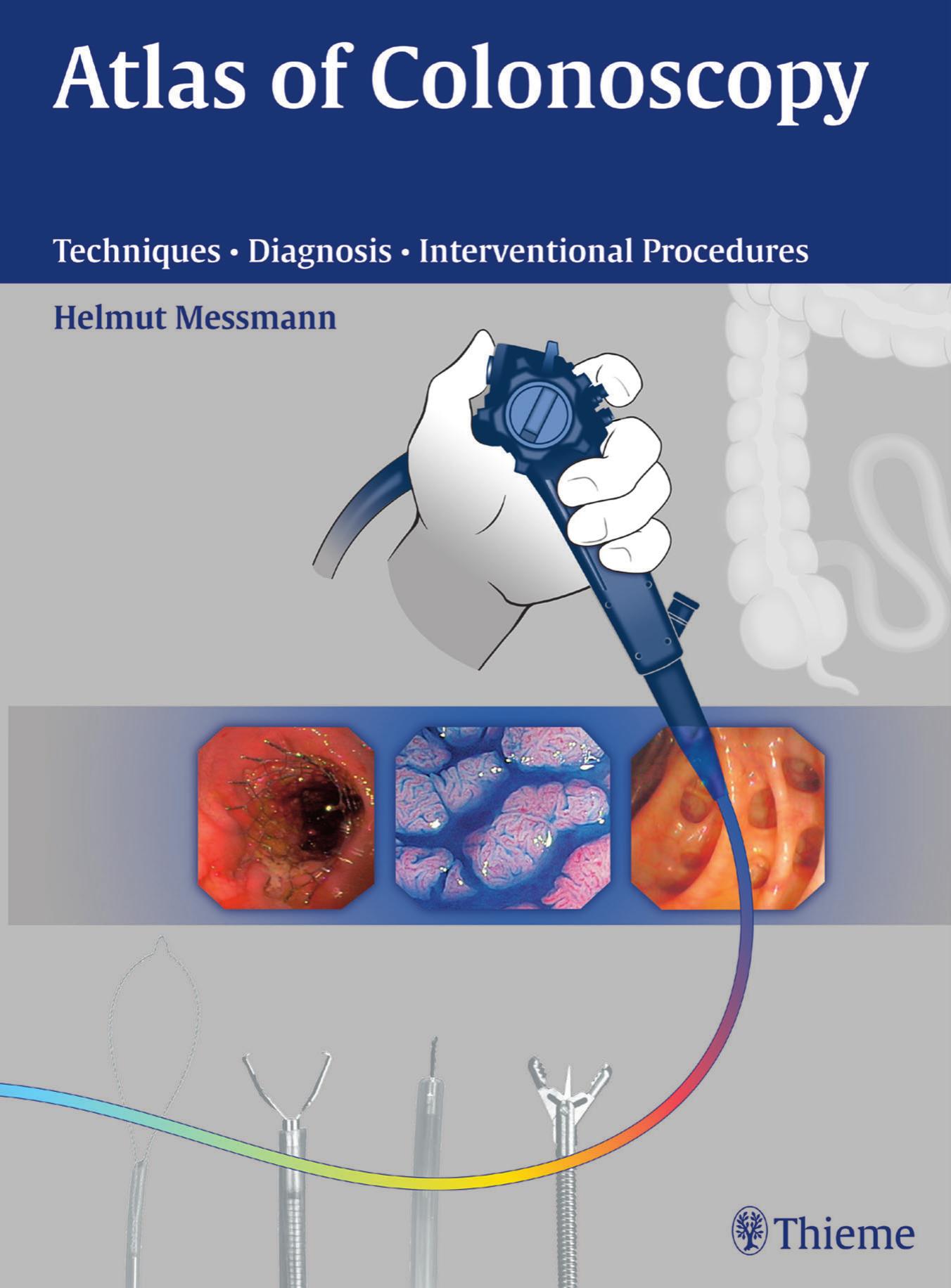 Atlas of Colonoscopy : Techniques, Diagnosis, Interventional Procedures by Techniques Diagnosis Interventional Procedures