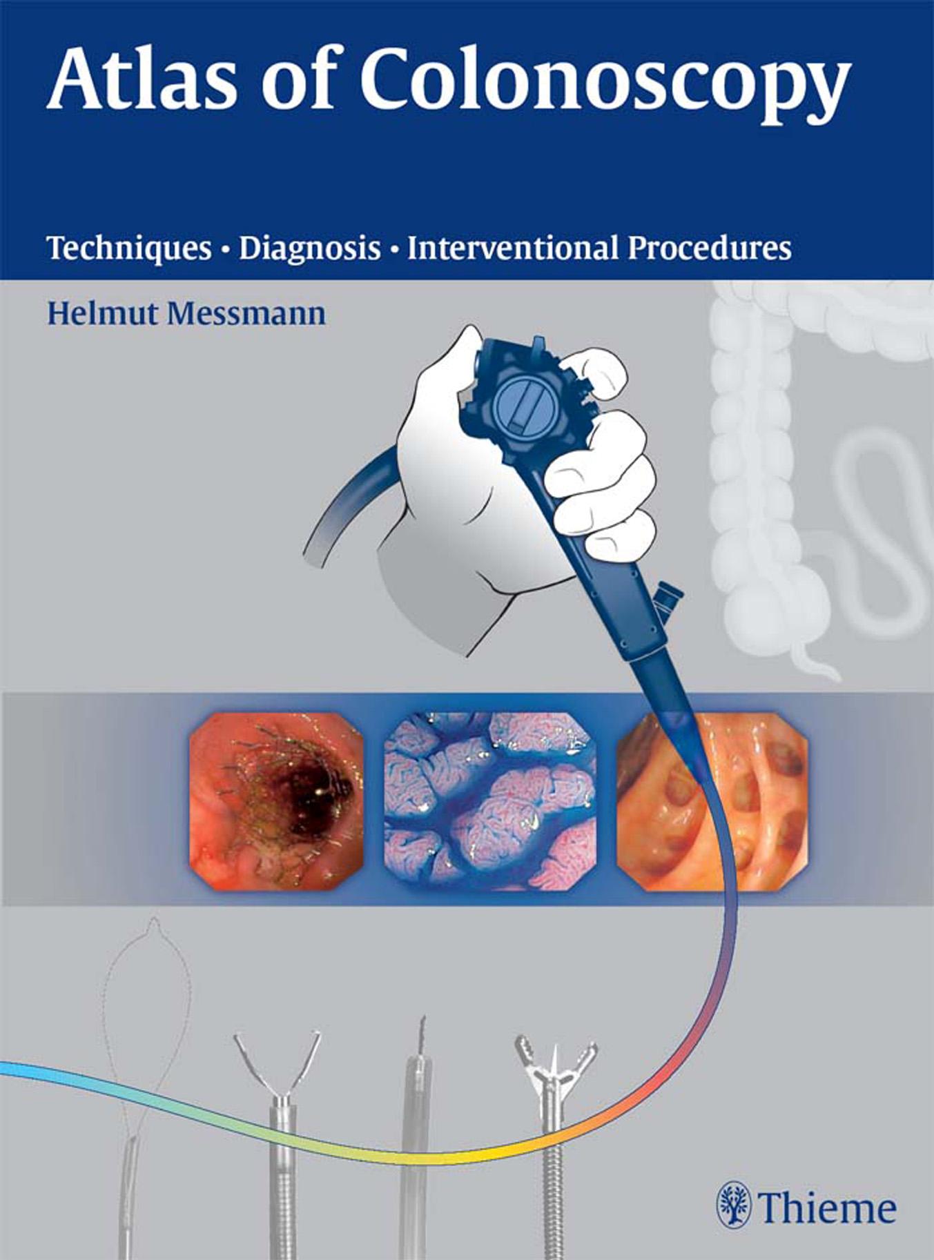 Atlas of Colonoscopy: Examination Techniques and Diagnosis by Helmut Messman