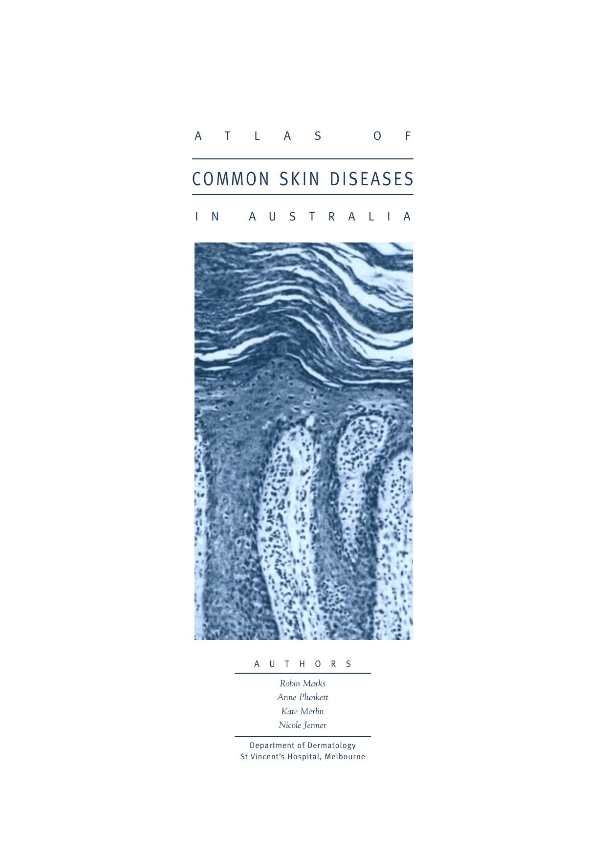 Atlas of Common Skin Diseases In Australia by Published by the Department of Dermatology St Vincent’s Hospital Melbourne