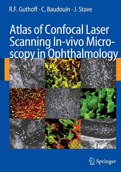 Atlas of Confocal Laser Scanning In-vivo Microscopy in Opthalmology by Principles & Applications in Diagnostic & Therapeutic Ophtalmology Guthoff Baudouin Stave 2006