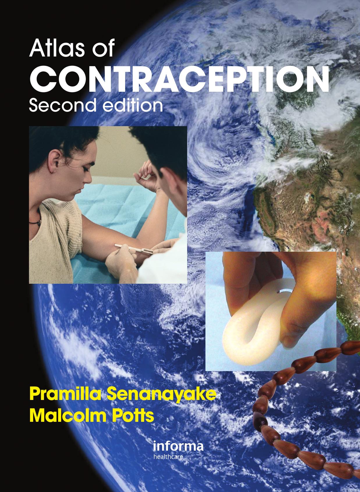 Atlas of Contraception, Second Edition (ENCYCLOPEDIA OF VISUAL MEDICINE SERIES) by Pramilla Senanayake; Malcolm Potts