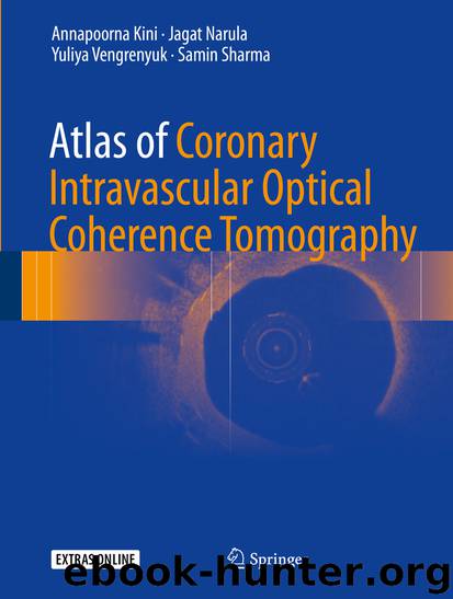 Atlas of Coronary Intravascular Optical Coherence Tomography by Annapoorna Kini Jagat Narula Yuliya Vengrenyuk & Samin Sharma