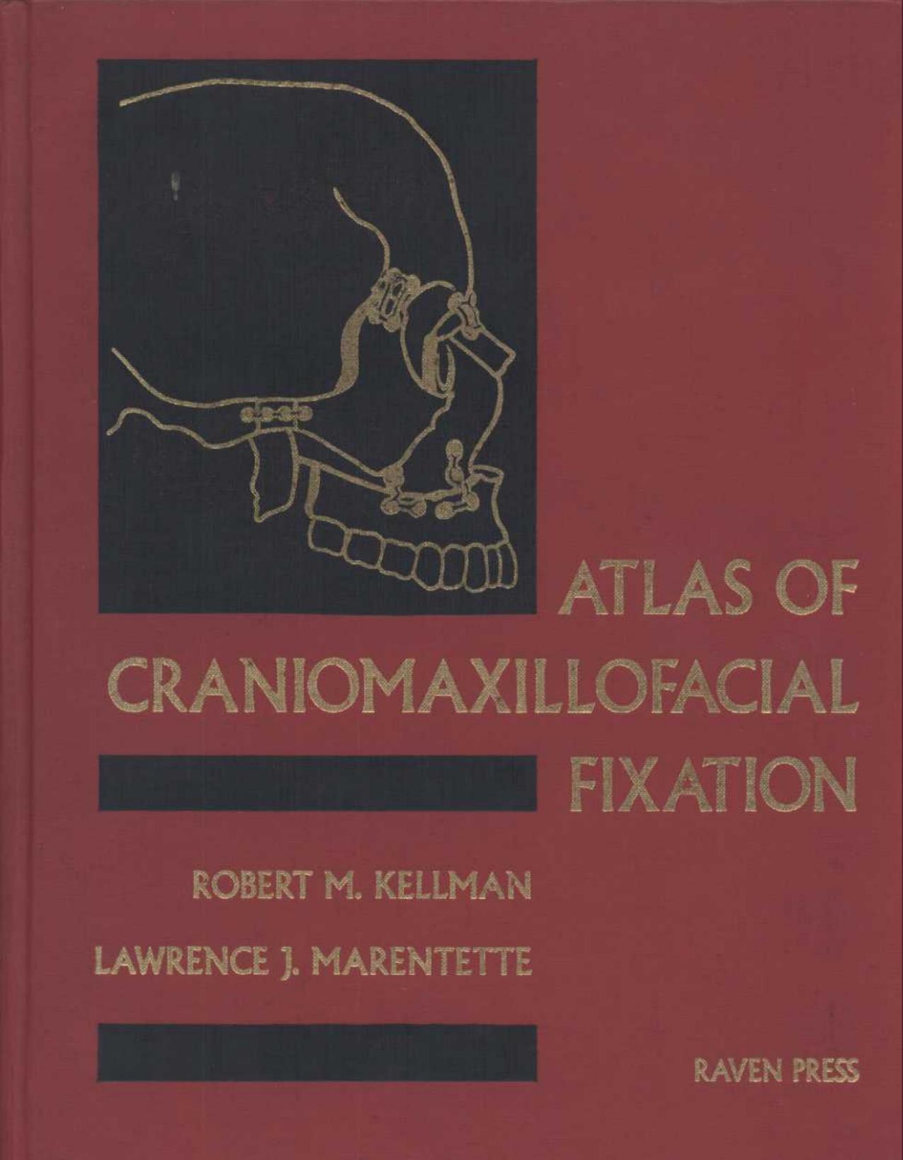 Atlas of Craniomaxillofacial Fixation by Unknown