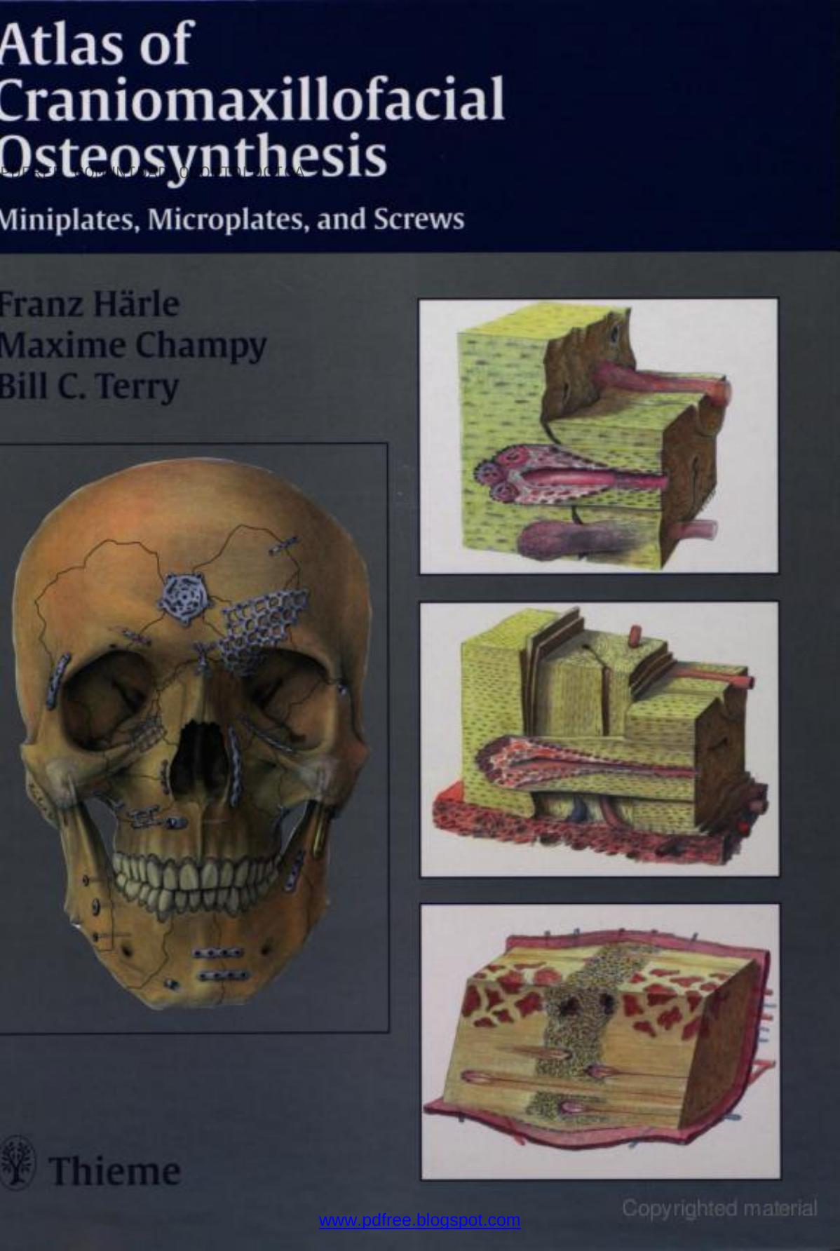 Atlas of Craniomaxillofacial Osteosynthesis: Micro-miniplates and Screws by F. Haerle etc