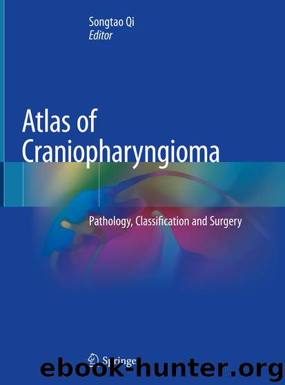 Atlas of Craniopharyngioma by Songtao Qi