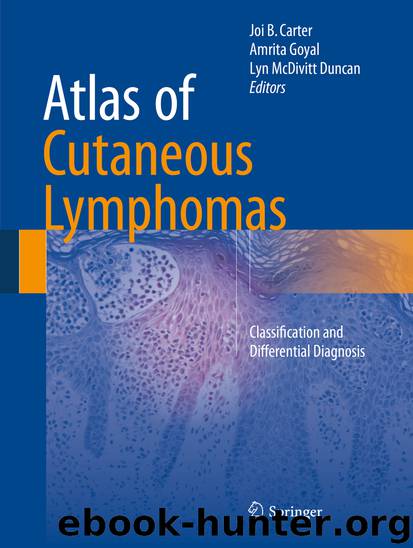 Atlas of Cutaneous Lymphomas by Joi B. Carter Amrita Goyal & Lyn McDivitt Duncan