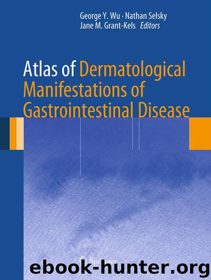 Atlas of Dermatological Manifestations of Gastrointestinal Disease by George Y. Wu Nathan Selsky & Jane M. Grant-Kels