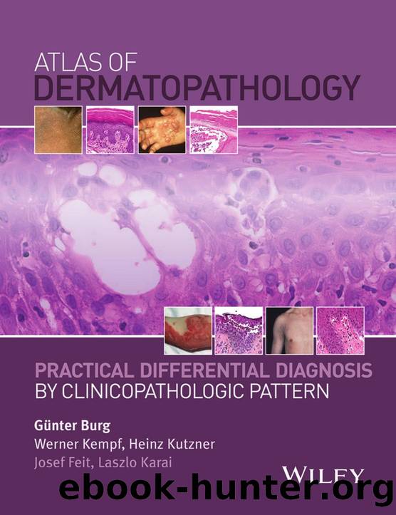 Atlas of Dermatopathology by Günter Burg MD