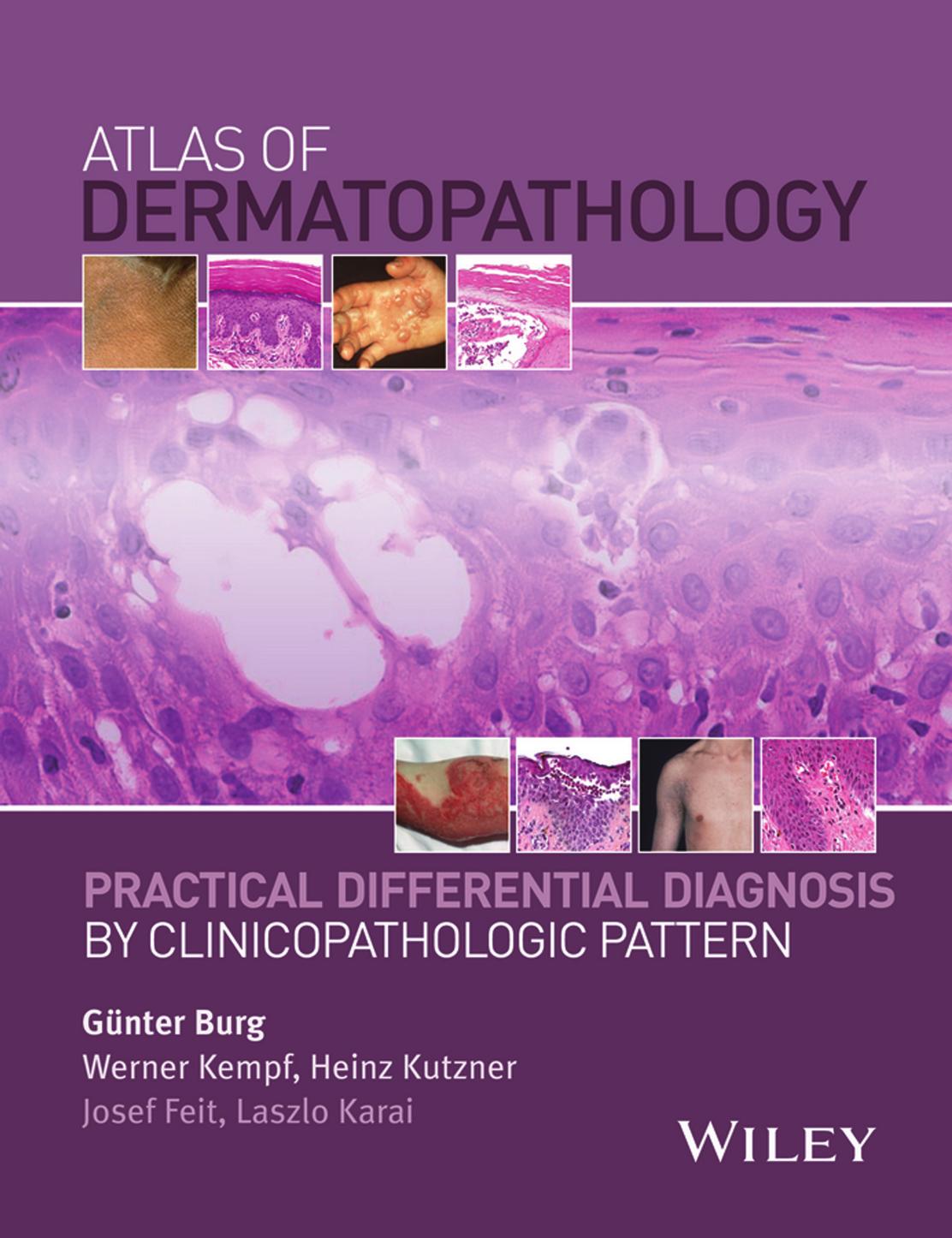 Atlas of Dermatopathology: Practical Differential Diagnosis by Clinicopathologic Pattern by Unknow