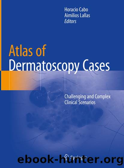 Atlas of Dermatoscopy Cases by Unknown