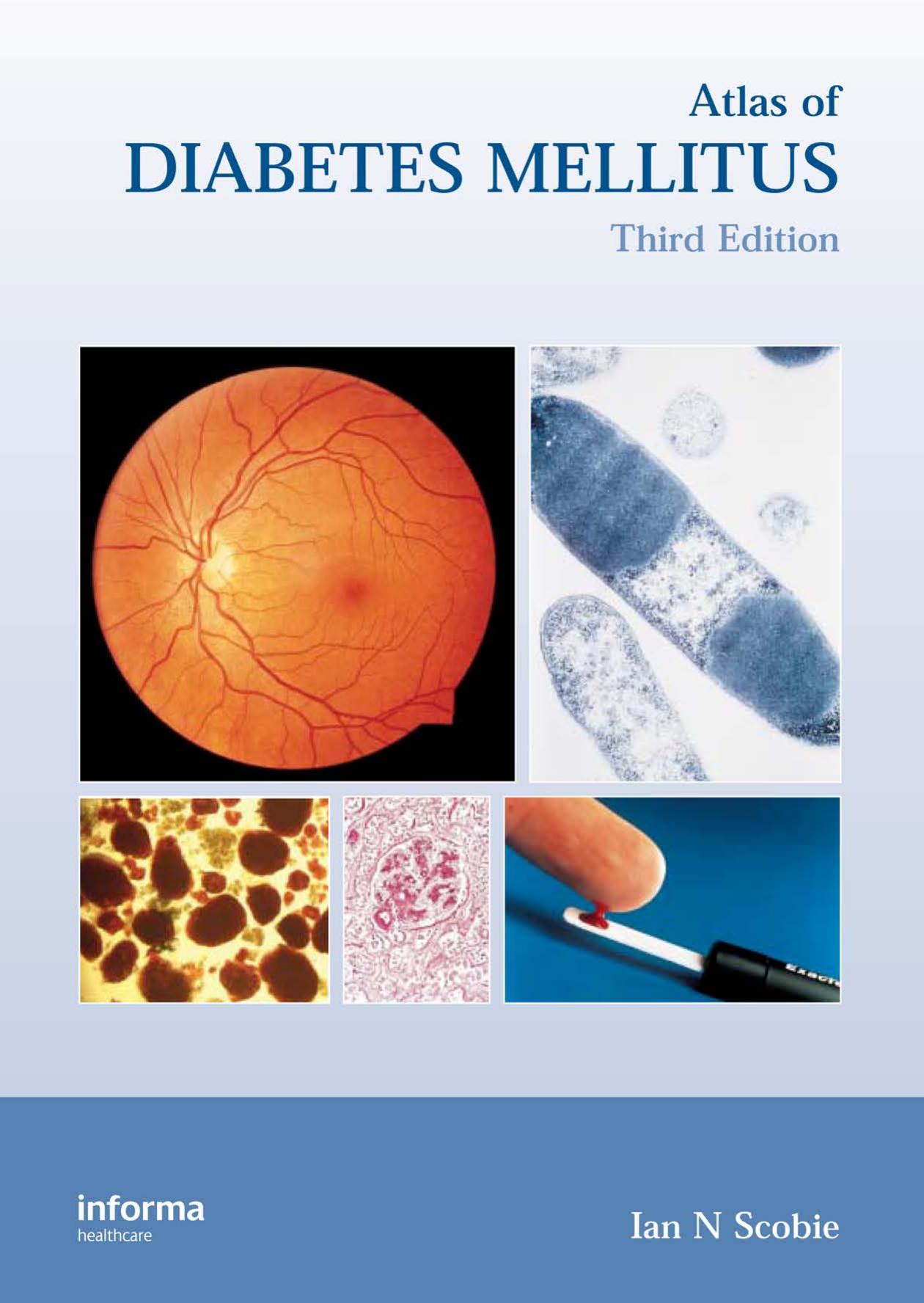Atlas of Diabetes Mellitus by Ian N. Scobie