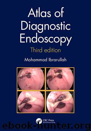 Atlas of Diagnostic Endoscopy, 3E by Ibrarullah Mohammad;