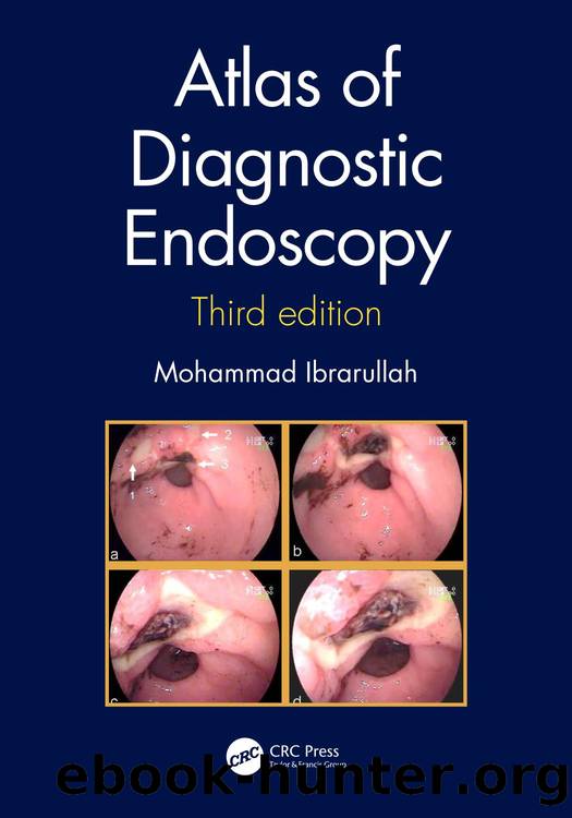 Atlas of Diagnostic Endoscopy; Third Edition by Mohammad Ibrarullah