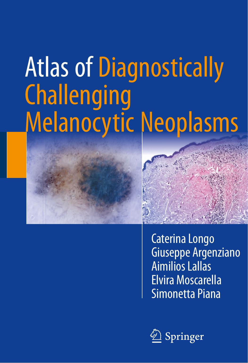 Atlas of Diagnostically Challenging Melanocytic Neoplasms by Caterina Longo Giuseppe Argenziano Aimilios Lallas Elvira Moscarella Simonetta Piana (auth.)