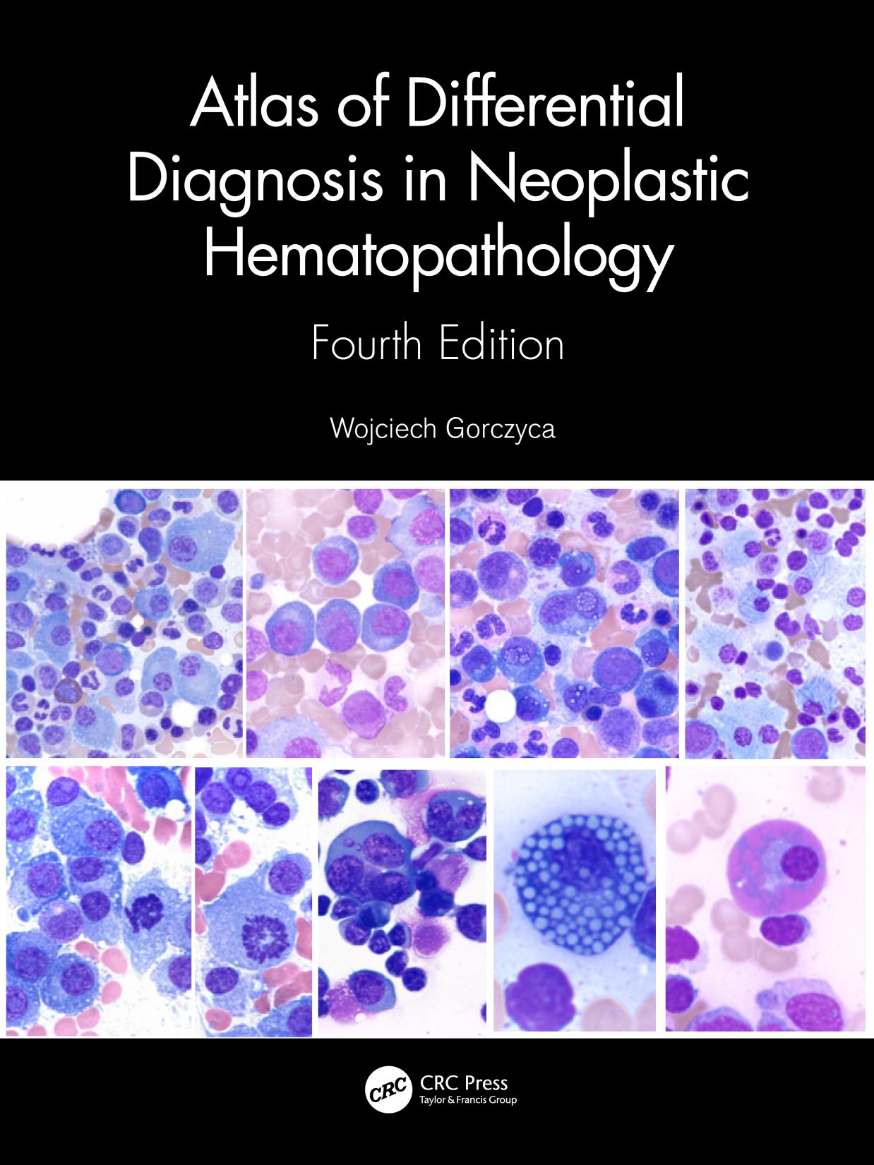 Atlas of Differential Diagnosis in Neoplastic Hematopathology by Wojciech Gorczyca