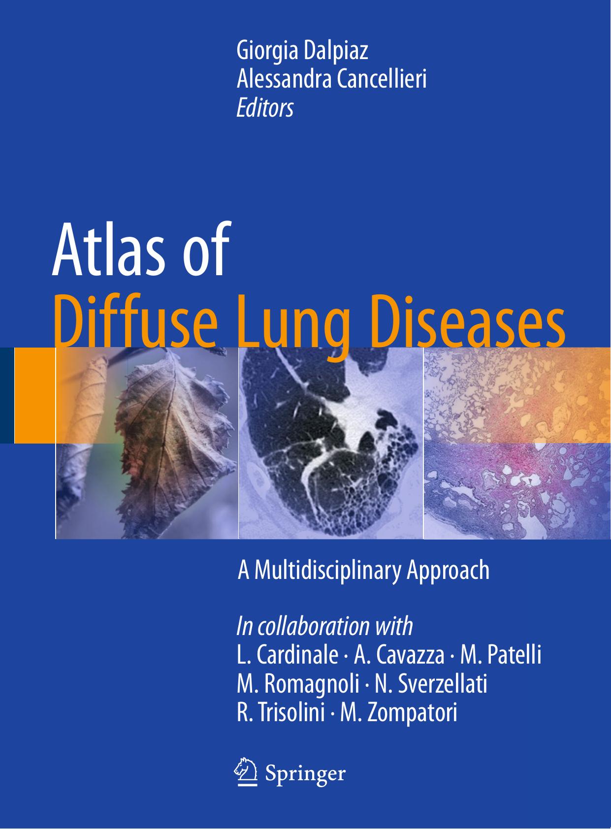 Atlas of Diffuse Lung Diseases: A Multidisciplinary Approach by Giorgia Dalpiaz Alessandra Cancellieri (eds.)