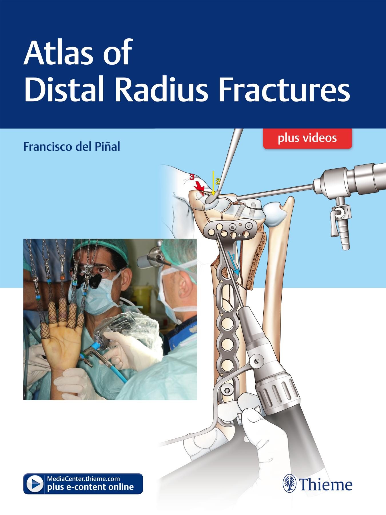 Atlas of Distal Radius Fractures by Francisco del Pinal