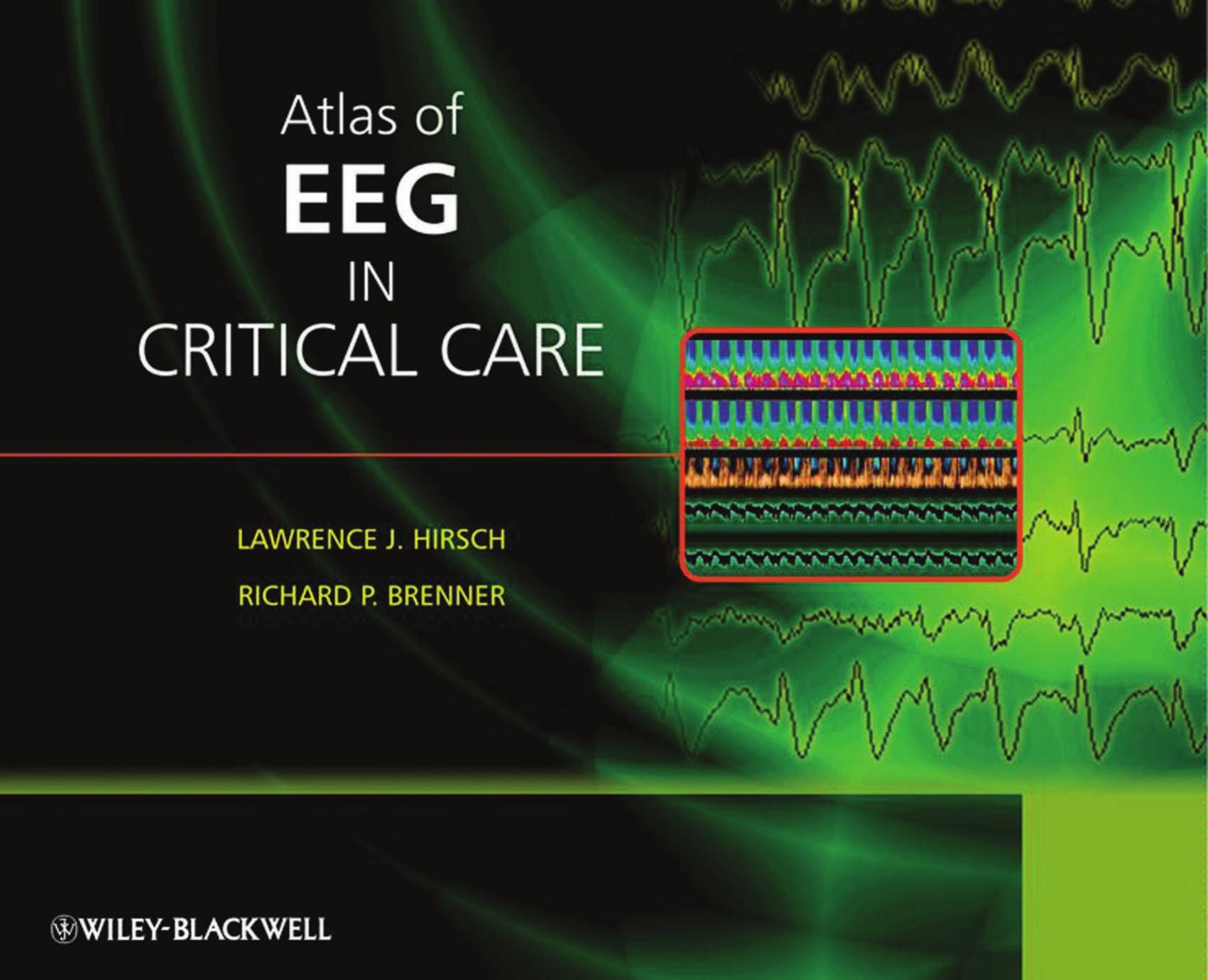 Atlas of EEG in Critical Care by Lawrence Hirsch Richard Brenner