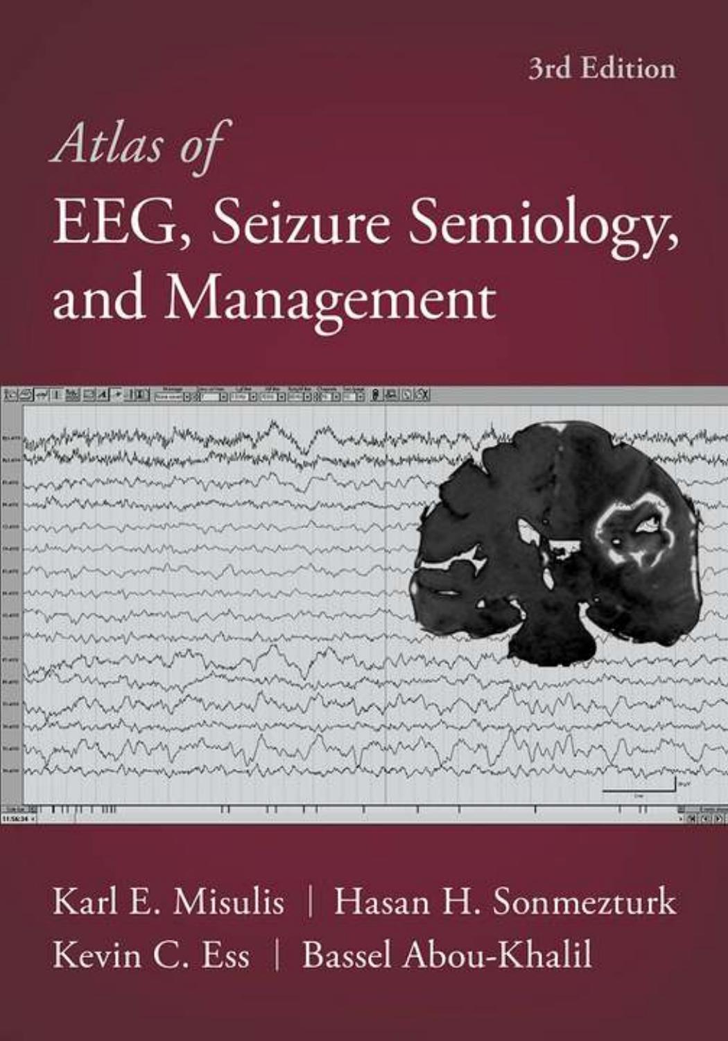 Atlas of EEG, Seizure Semiology, and Management [Team-IRA] (True PDF) by Bassel Abou-Khalil Karl Edward Misulis Hasan Sonmezturk Kevin C. Ess