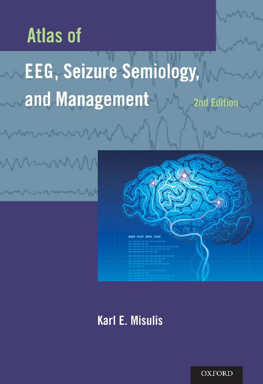 Atlas of EEG, Seizure Semiology, and Management 2nd Edition by Unknow