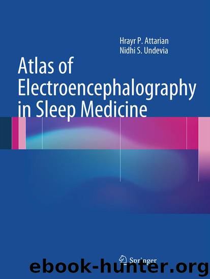 Atlas of Electroencephalography in Sleep Medicine by Hrayr P. Attarian & Nidhi S. Undevia