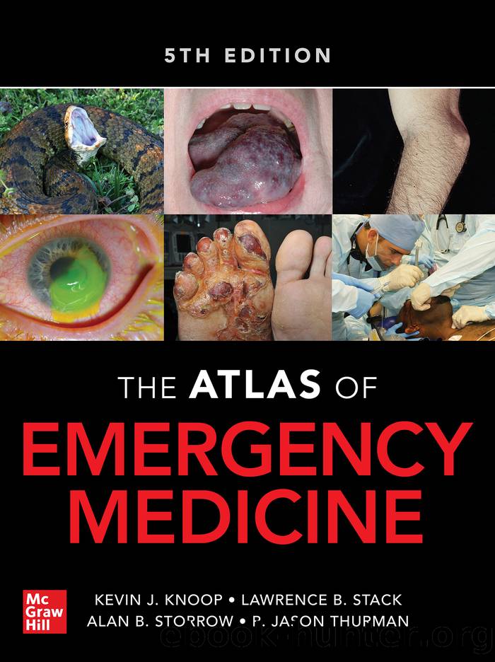 Atlas of Emergency Medicine by Kevin J. Knoop