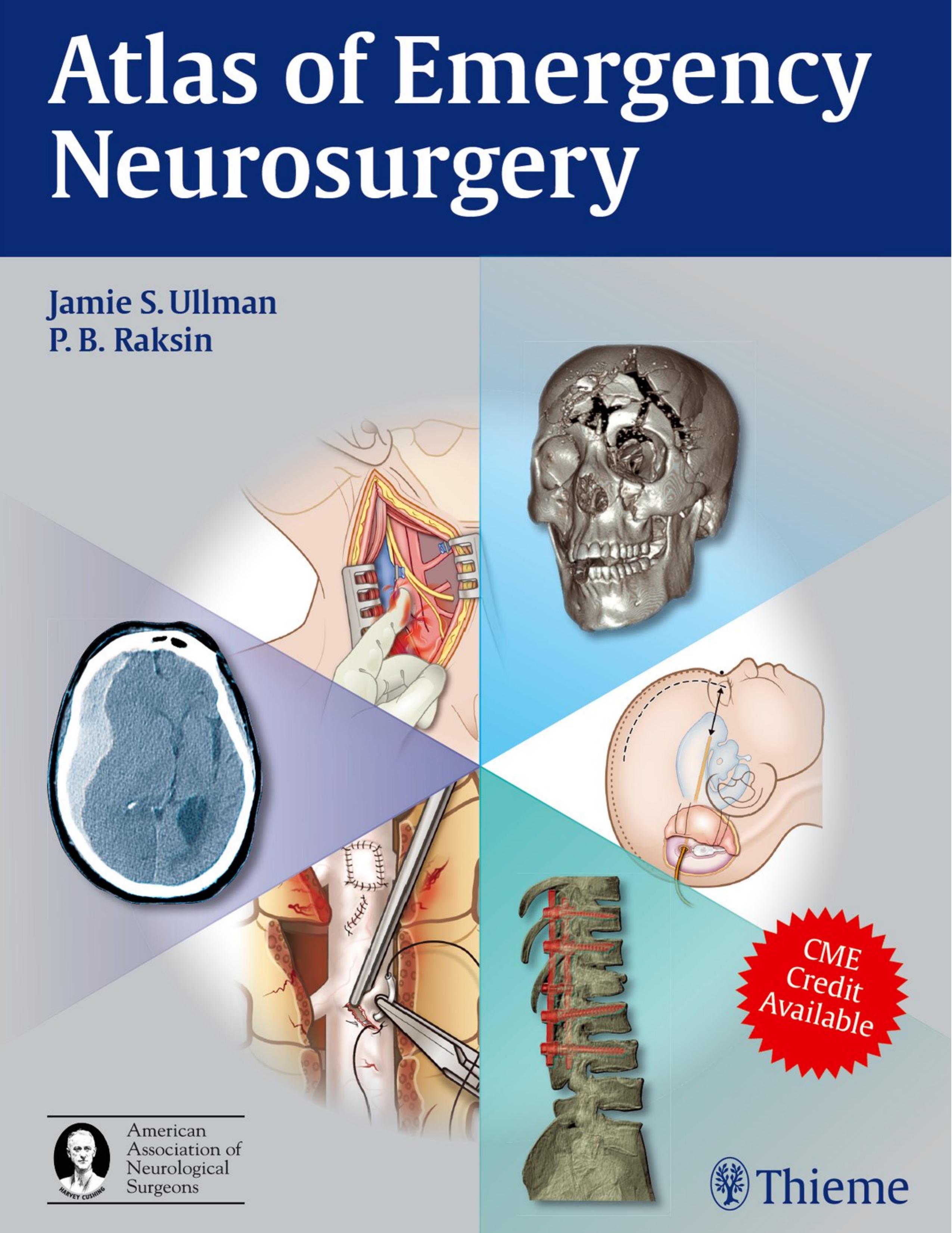 Atlas of Emergency Neurosurgery by Unknown
