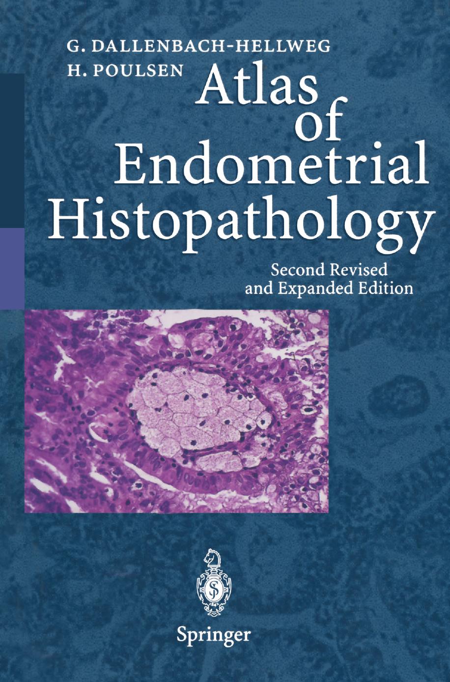 Atlas of Endometrial Histopathology by Gisela Dallenbach-Hellweg M.D. F.I.A.C. Hemming Poulsen M.D. (auth.)
