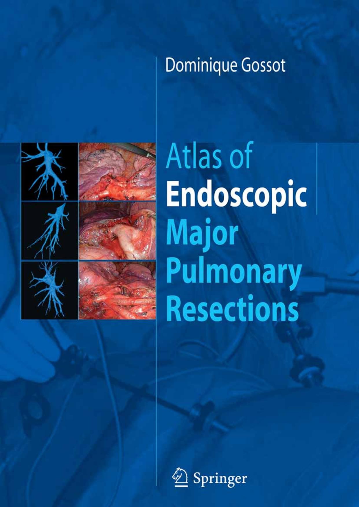 Atlas of Endoscopic Major Pulmonary Resections by Dominique Gossot