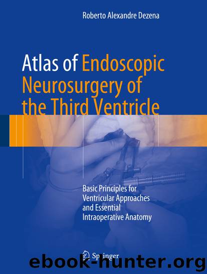 Atlas of Endoscopic Neurosurgery of the Third Ventricle by Roberto Alexandre Dezena