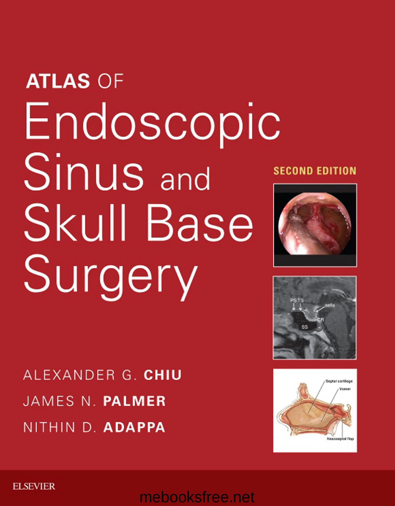 Atlas of Endoscopic Sinus and Skull Base Surgery by Alexander Chiu James Palmer Nithin Adappa