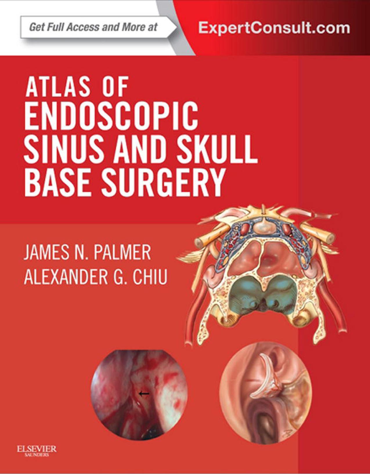 Atlas of Endoscopic Sinus and Skull Base Surgery by James N. Palmer Alexander Chiu