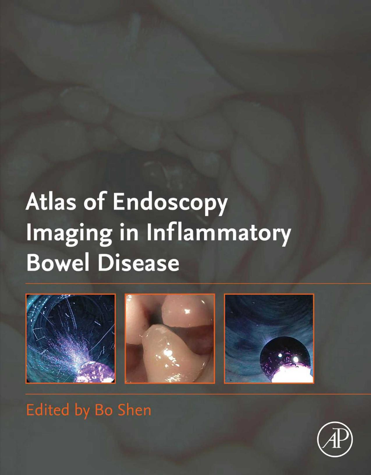 Atlas of Endoscopy Imaging in Inflammatory Bowel Disease by Bo Shen M.D. (editor)