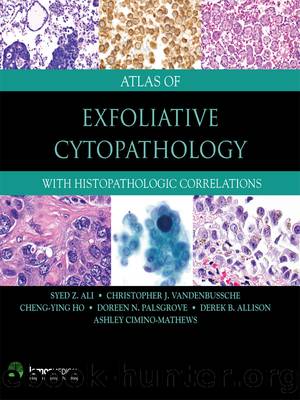 Atlas of Exfoliative Cytopathology by unknow