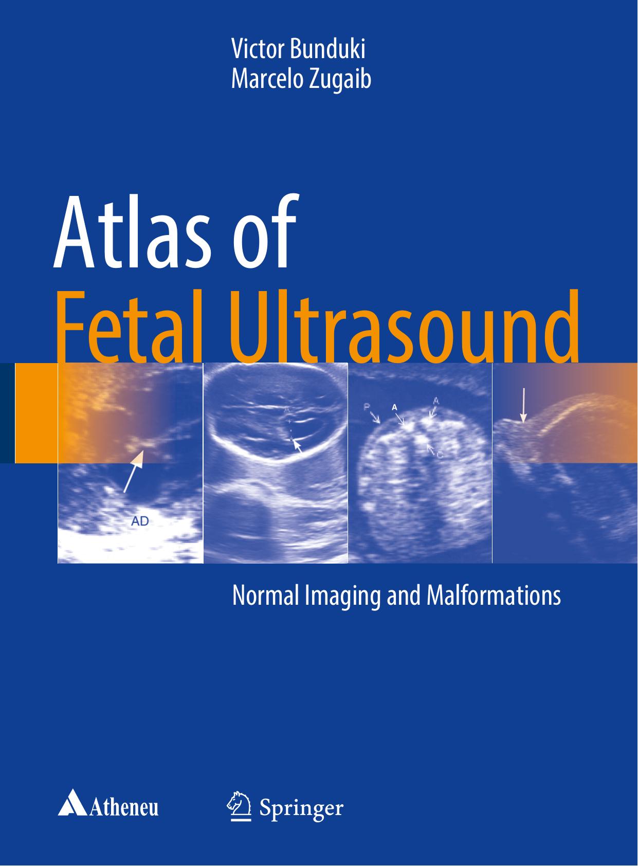 Atlas of Fetal Ultrasound: Normal Imaging and Malformations by Victor Bunduki Marcelo Zugaib (auth.)