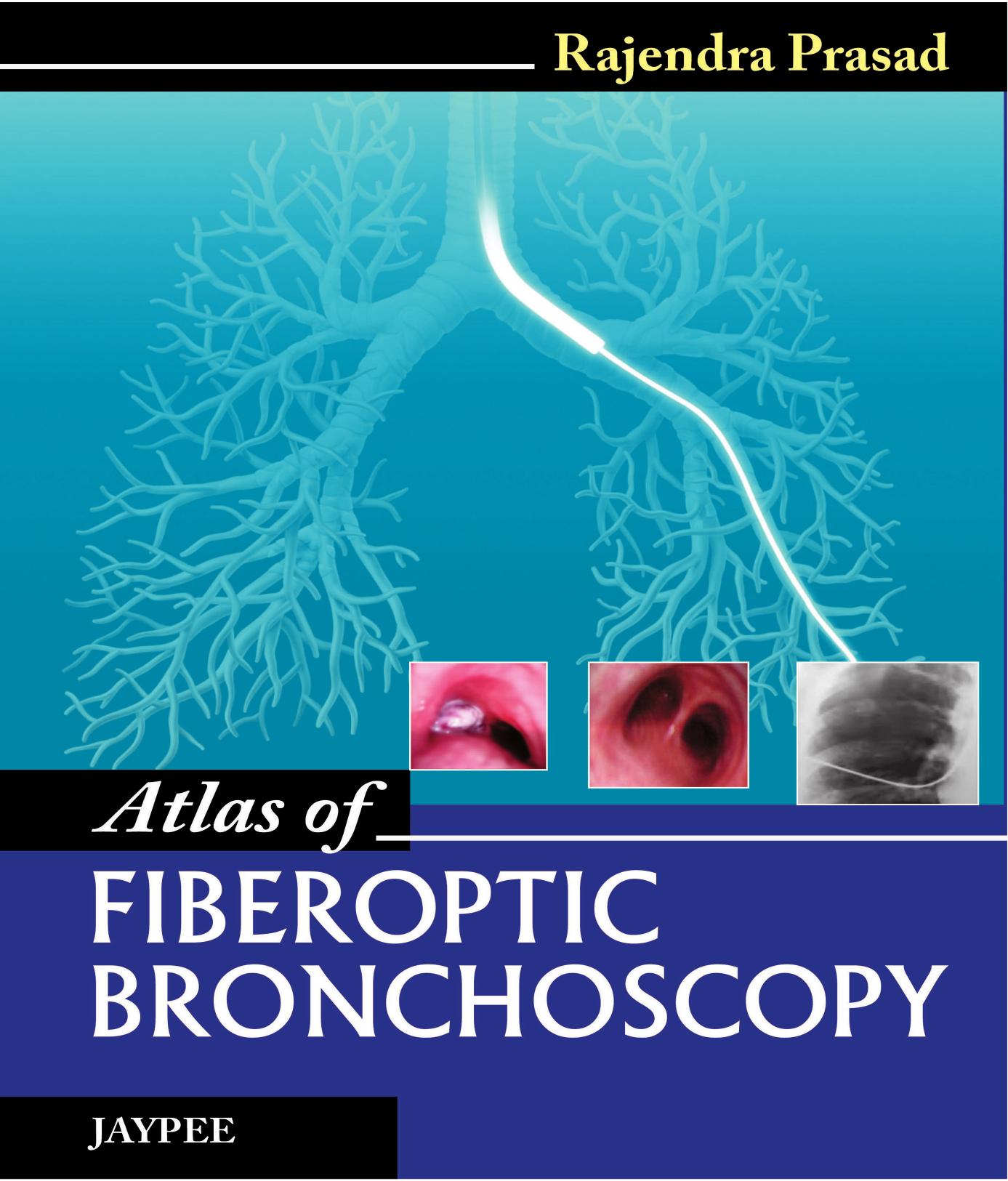 Atlas of Fiberoptic Bronchoscopy by Rajendra Prasad