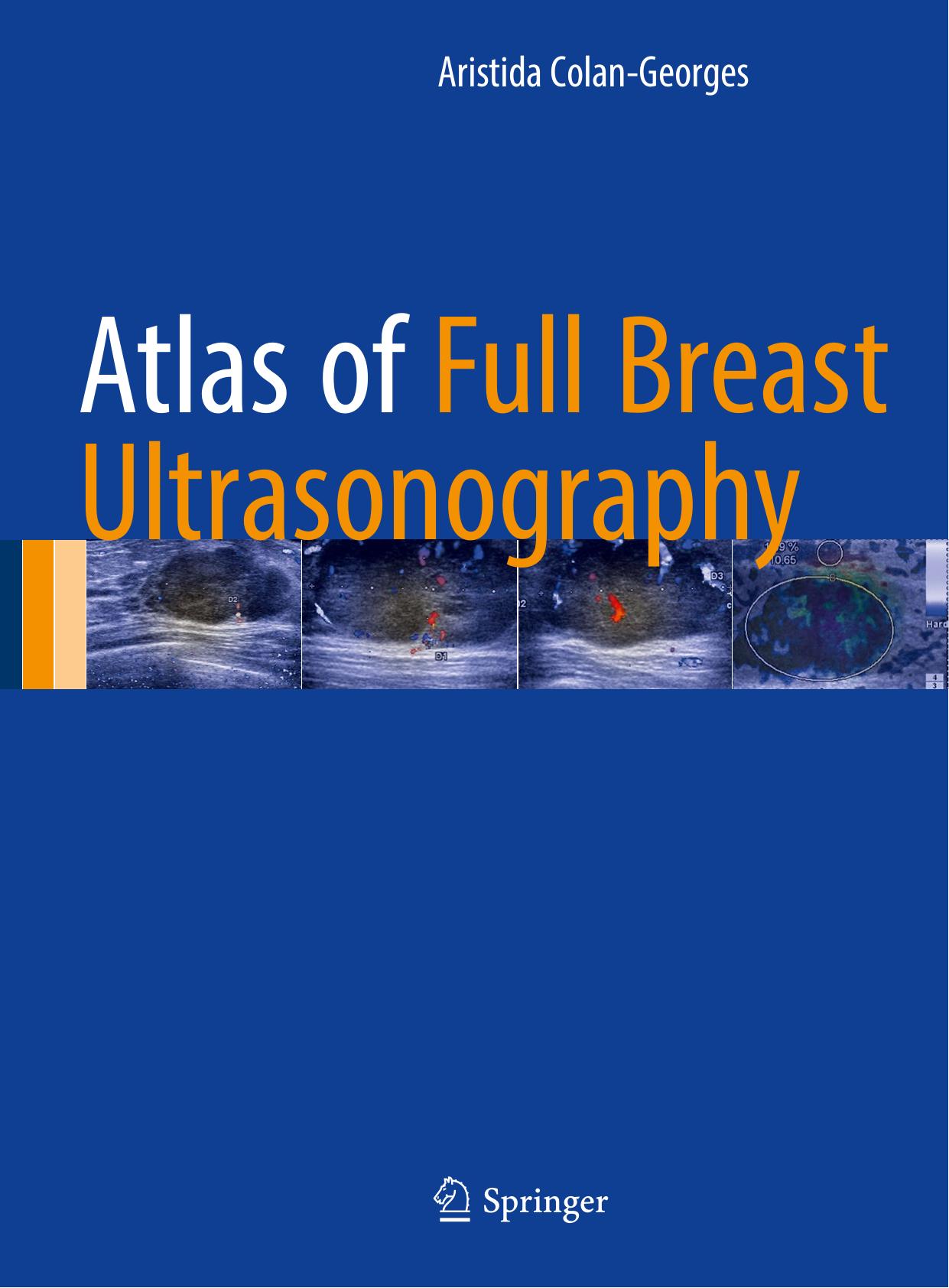 Atlas of Full Breast Ultrasonography by Unknown