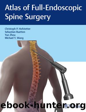 Atlas of Full-Endoscopic Spine Surgery by Hofstetter Christoph P.; Ruetten Sebastian; Zhou Yu'e