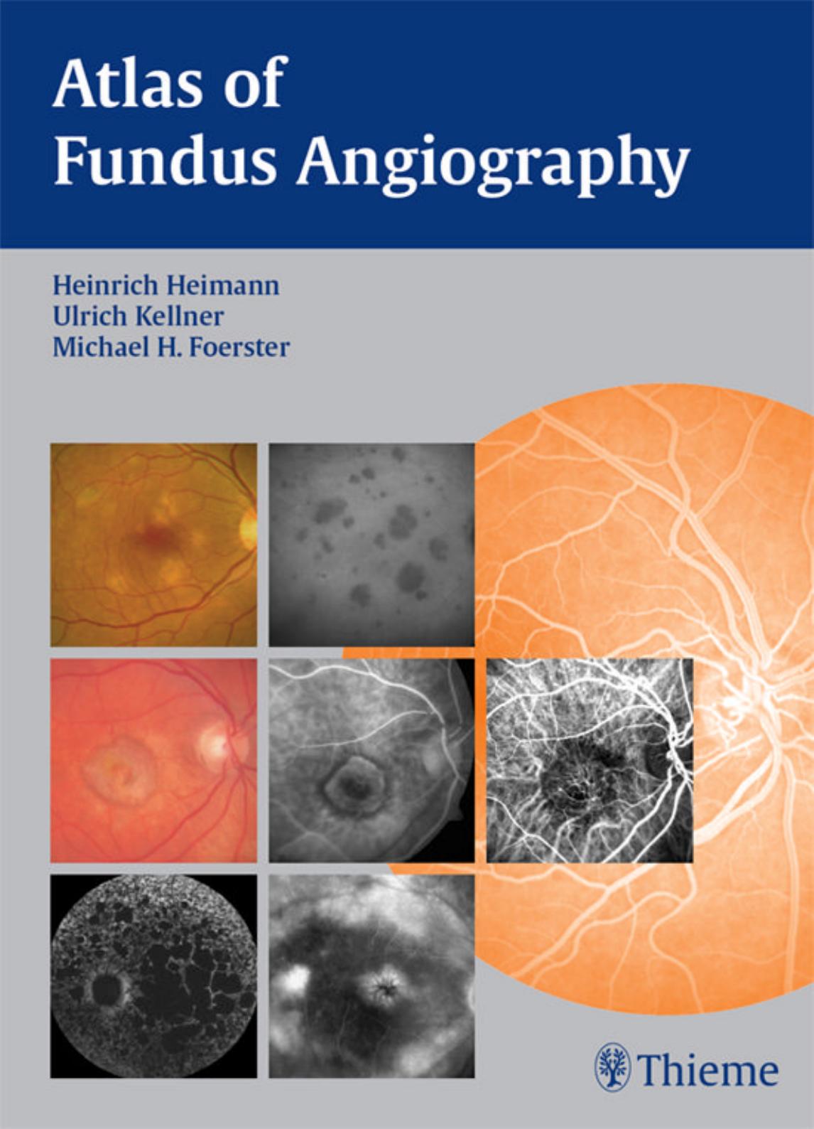 Atlas of Fundus Angiography by Heinrich Heimann and Ulrich Kellner